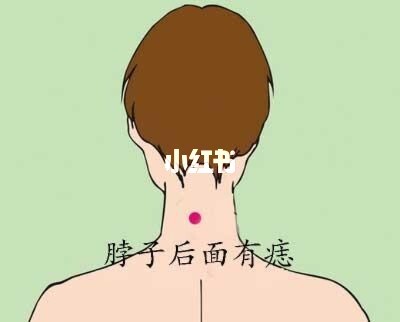 脖子上有痣代表什么_男人脖子上有痣代表什么_后脖子上有痣代表什么