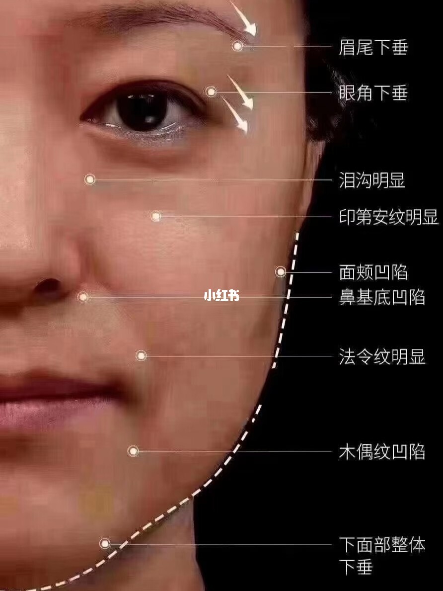 额头竖纹<strong>面相</strong>图解 有竖纹的额头<strong>面相</strong>图