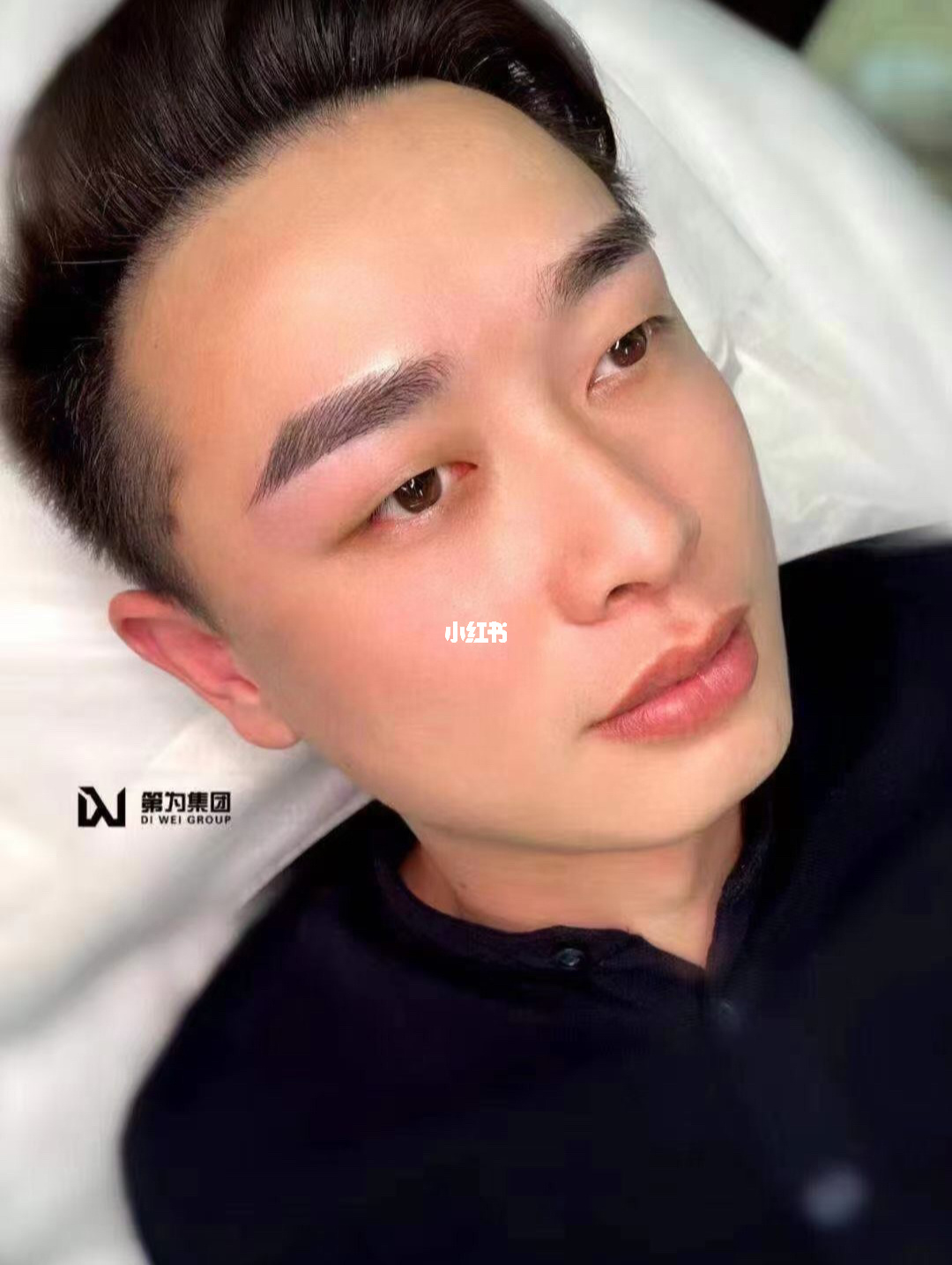 男人面部<strong>痣相</strong>最准图，男人面部<strong>痣相</strong>图解大全