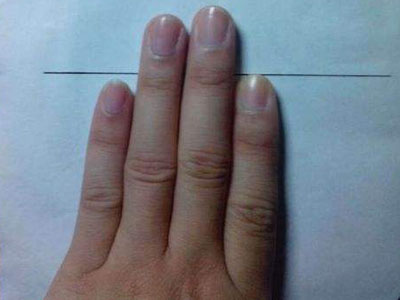 食指接指手术_女性的无名指长比食指长_无名指比食指长