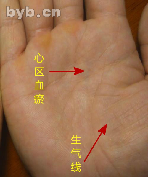 痣<strong>相学</strong>手背,手上长痣
