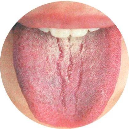 单锁舌 双锁舌_门锁单舌和双舌哪个好_姓舌