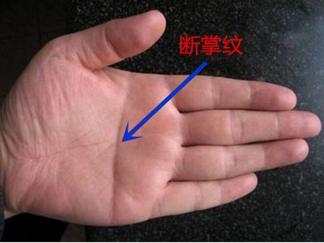 手纹断掌是什么意思_断掌手纹算命图解_手纹断掌
