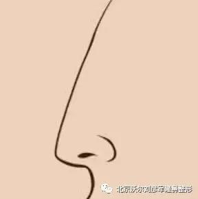 鸭嘴型接线鼻_14种鼻型图解_马具型口枷鼻钩图片