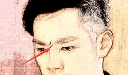<strong>痣相</strong>图解：眉心长痣代表什么