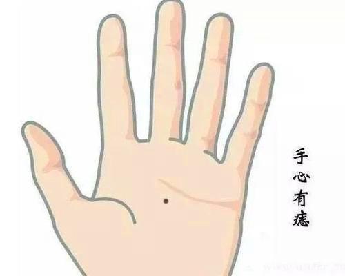 手指上有痣能说明什么？