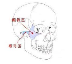 颧骨在哪里_颧骨高的男人面相_颧骨高的女人面相