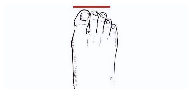 脚形_脚形状分类_脚形状图片