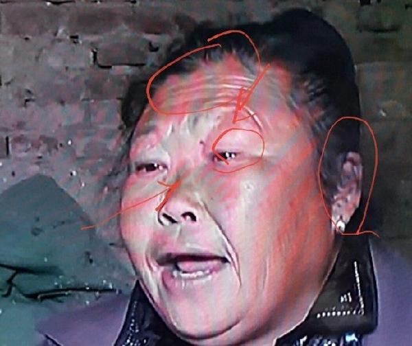 女人面部<strong>痣相</strong>图解大全
