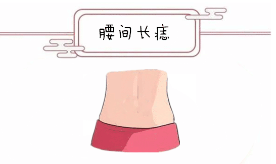 女人10处有痣是富贵痣 <strong>痣相</strong>学分析